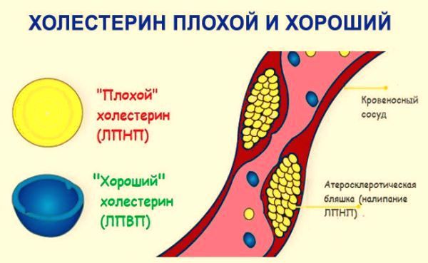 Плохой холестерин: как уменьшить с гомеопатией